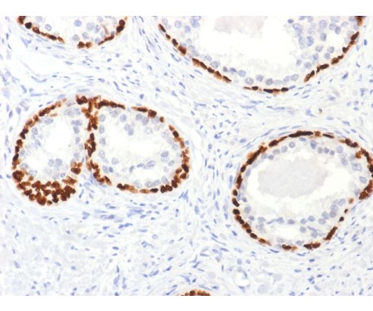 P Squamous Basal Myoepithelial Cell Marker Ug