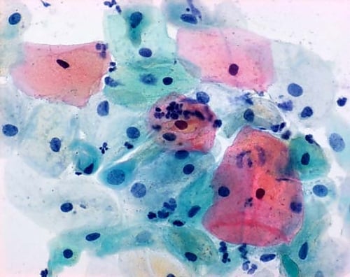 はると 61-0301-75 パパニコロウ染色液 2a, OG-6 パパニコロウ染色用 106888