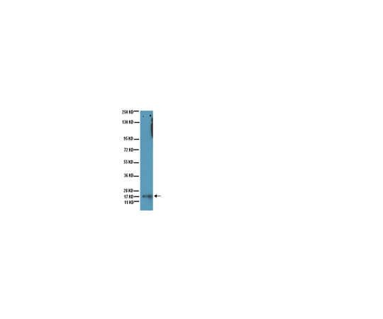 Anti-acetyl-Lysine, clone 4G12; 100 μg