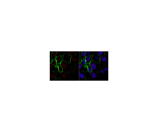 62-8372-01 Anti-Nibrin Nbs1 Antibody 超特価 clone EE15 Free 最適な価格 Ascites 05-616-C