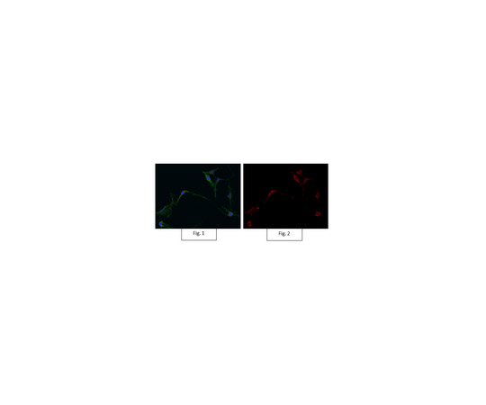 Anti-Active-β-Catenin Antibody, clone 8E7, Alexa Fluor(R) 647