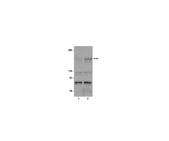 Anti-phospho-KDR/Flk-1/VEGFR2 (Tyr1214); 200 μg