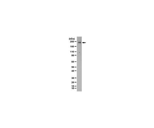 Anti-KDR/Flk-1/VEGFR2