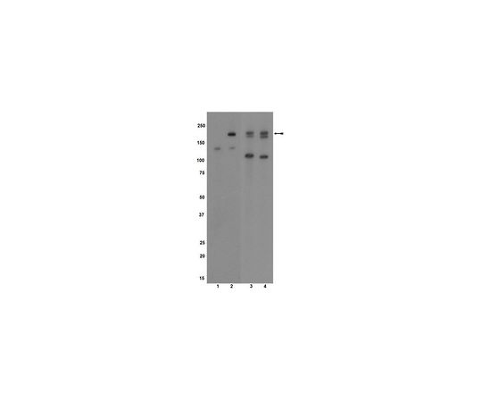 Anti-phospho-VEGFR2/Flk-1/KDR (Tyr1054); 100 μg