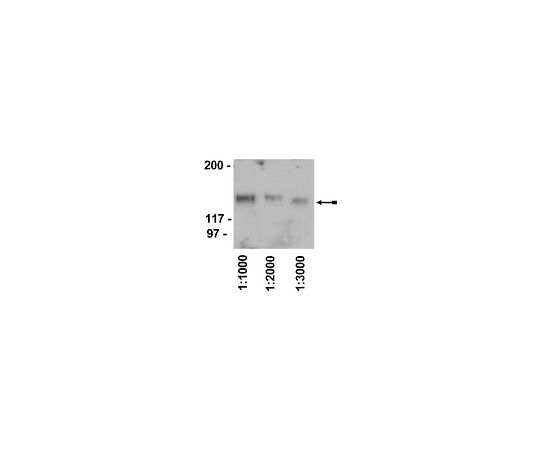 Rabbit anti-Chicken IgY, HRP conjugate; 500 μg 12-341