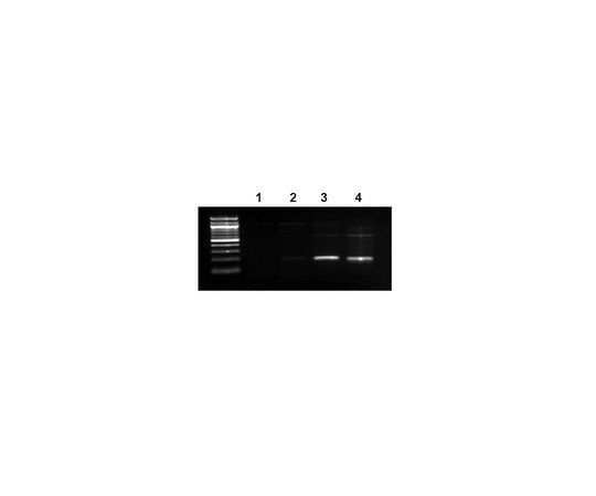 EZ-Magna ChIP(TM) A Chromatin Immunoprecipitation Kit; 22 assays