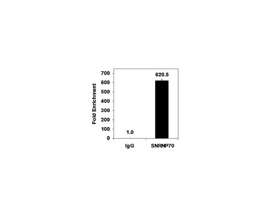 Magna RIP(TM) RNA-Binding Protein Immunoprecipitation Kit; 12 assays