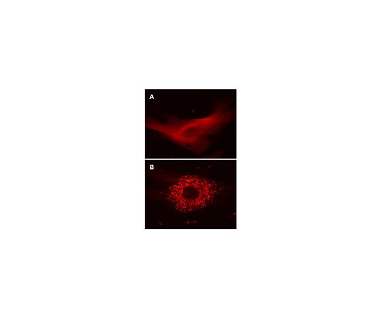LentiBrite(TM) RFP-LC3 Lentiviral Biosensor