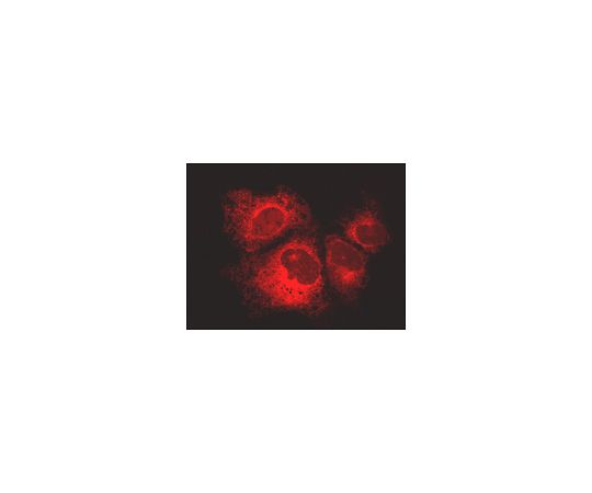 LentiBrite(TM) Calreticulin-RFP-KDEL Lentiviral Biosensor