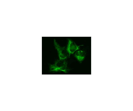 LentiBrite(TM) GFP-Vimentin Lentiviral Biosensor