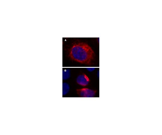 LentiBrite(TM) RFP-Vimentin Lentiviral Biosensor