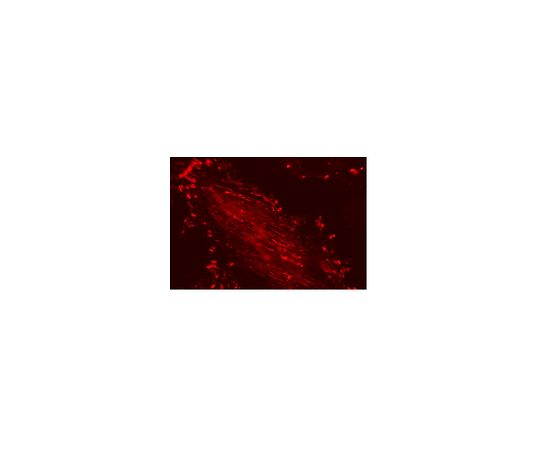 LentiBrite(TM) Paxillin-RFP Lentiviral Biosensor