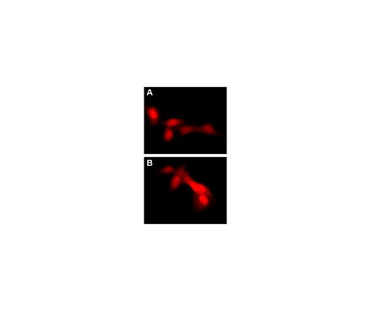 LentiBrite(TM) RFP-LC3 Control Mutant Lentiviral Biosensor