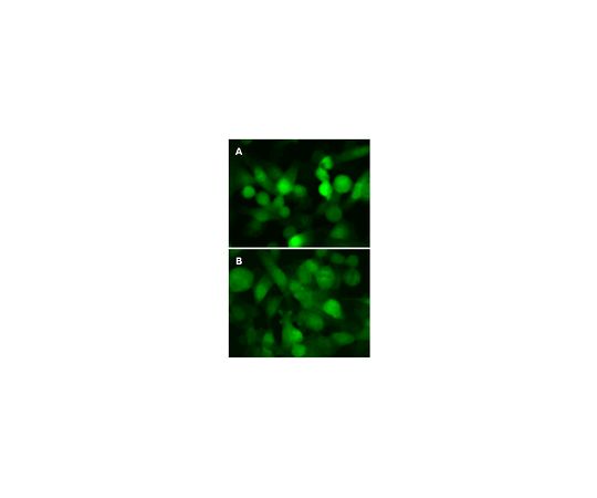 LentiBrite(TM) GFP-LC3 Control Mutant Lentiviral Biosensor