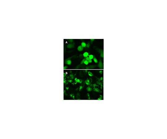 LentiBrite(TM) GFP-LC3 Lentiviral Biosensor