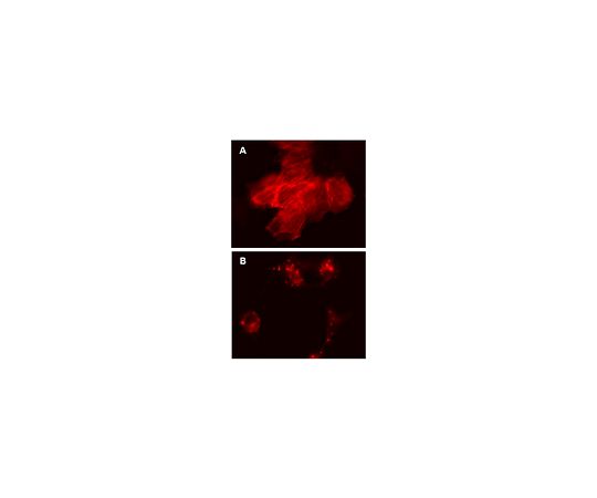 LentiBrite(TM) RFP-β-actin Lentiviral Biosensor