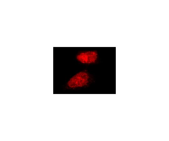 LentiBrite(TM) RFP-Rad51 Lentiviral Biosensor