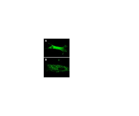 LentiBrite(TM) GFP-p62 Lentiviral Biosensor