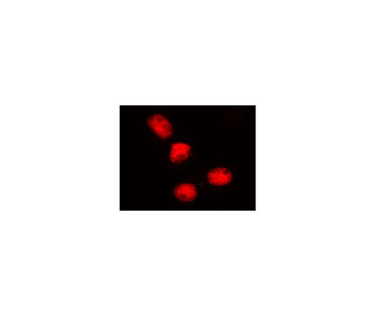LentiBrite(TM) Histone H2B-RFP Lentiviral Biosensor