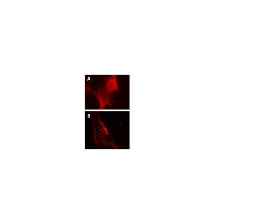 LentiBrite(TM) RFP-p62 Lentiviral Biosensor