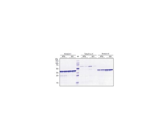 Overnight Express(TM) Autoinduction NMR Medium - 15N