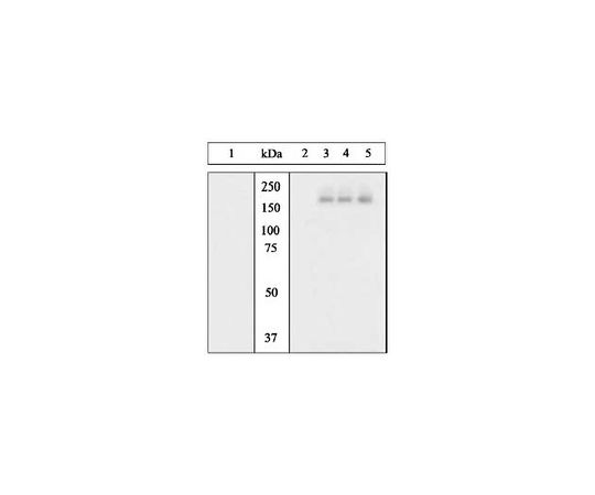 PhosphoDetect(TM) Anti-Epidermal Growth Factor Receptor (pTyr1068) Rabbit pAb