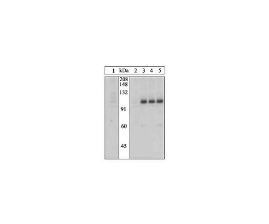 PhosphoDetect(TM) Anti-Insulin Receptor (pTyr1162/1163) Rabbit pAb