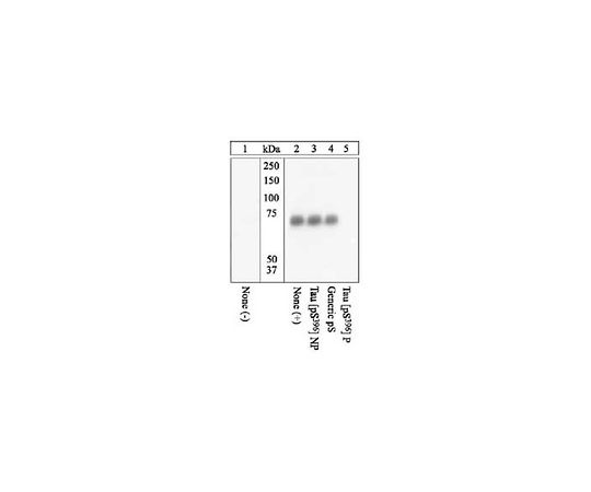 PhosphoDetect(TM) Anti-Tau (pSer396) Rabbit pAb