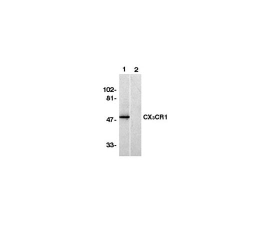 62-8445-96 Anti-C-X-X-X-C Chemokine Receptor 1, N-terminus; 100 μg AB1892