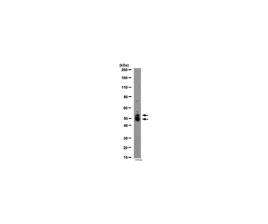 Anti-MMP-12, N-term (active); 100 μg