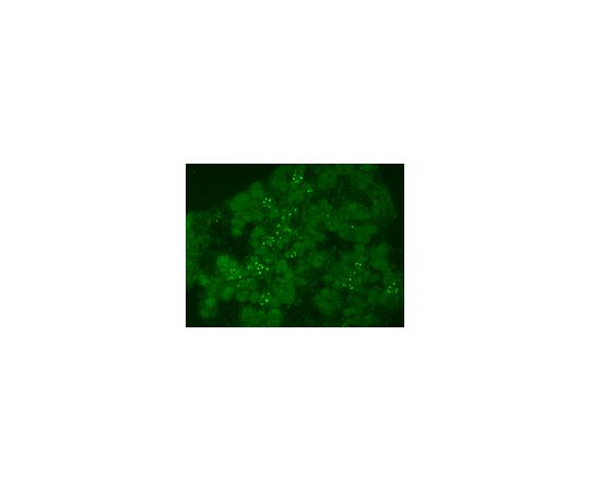 Anti-Neurogenin-3 (rabbit polyclonal); 100 μl