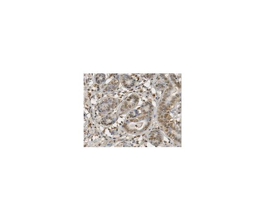 Anti-Anti-E3 ubiquitin-protein ligase UHRF1