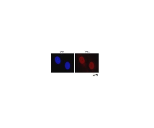 Anti-KAP-1/TRIM28 Antibody ABE1859