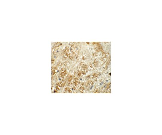 Anti-ATP2C1