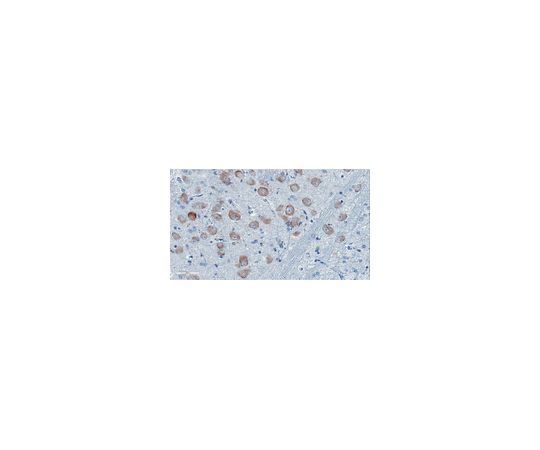 Anti-ApoE4 Fragment nApoECF Antibody (Asp172)