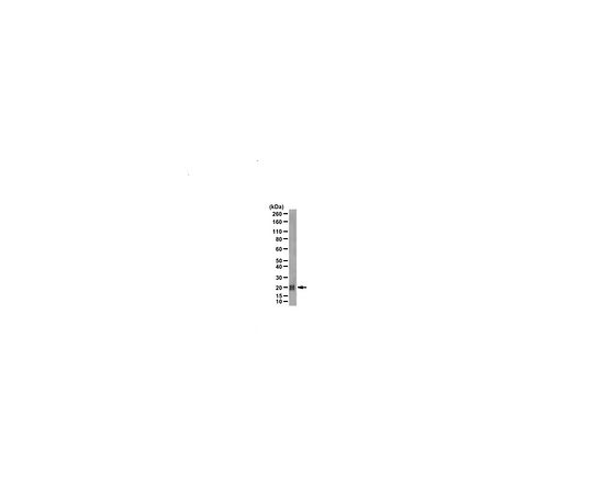 Anti-CDC42 Antibody, Brain Isoform-specific