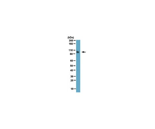 Anti-Fibroblast activation protein alpha （FAP）; 100 μg ABT11