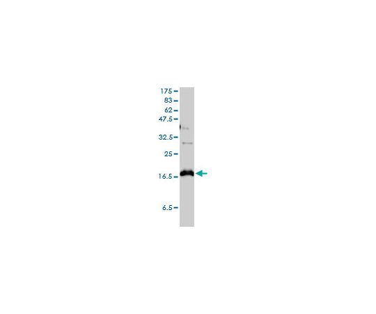 Anti-CLDN1 Mouse mAb (1C5-D9)