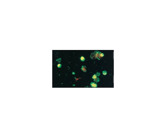 Anti-Coxsackievirus A9, clone 450-11G-8A-5E; 100 μL MAB947