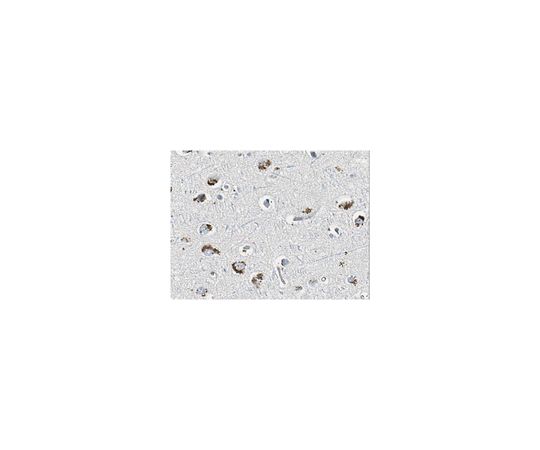 Anti-GABAA Antibody γ2 Subunit, clone KC4-8A7