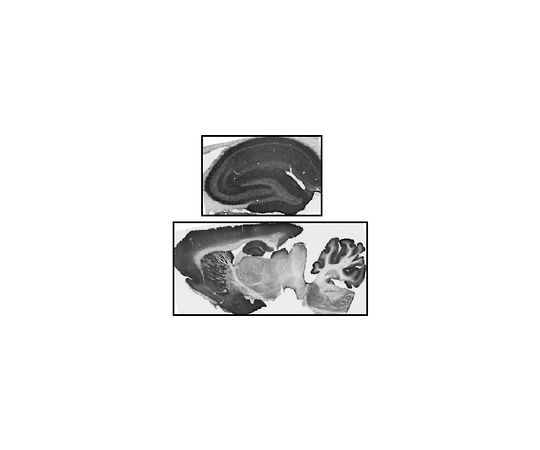 Anti-GABA(A) Receptor α2 Antibody, clone N399/19