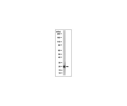 Anti-Betacellulin Antibody, clone 6G10.1