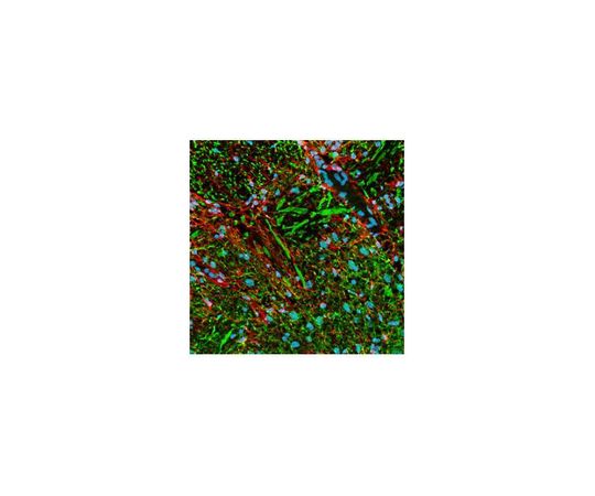 PhosphoDetect(TM) Anti-Neurofilament-H Mouse mAb (SMI-31)