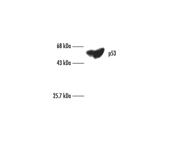 Anti-p53 (Ab-6) (Pantropic) Mouse mAb (DO-1)