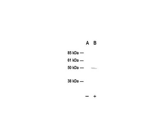 PhosphoDetect(TM) Anti-p53 (pSer15) (Ab-3) Rabbit pAb