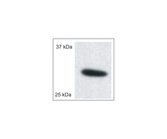 Anti-Porin (Ab-5) (185-197) Rabbit pAb