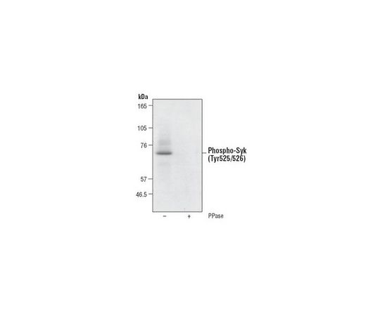 PhosphoDetect(TM) Anti-Syk (pTyr525/526) Rabbit pAb