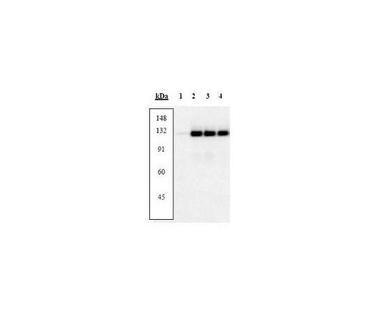 PhosphoDetect(TM) Anti-FAK (pTyr861) Rabbit pAb