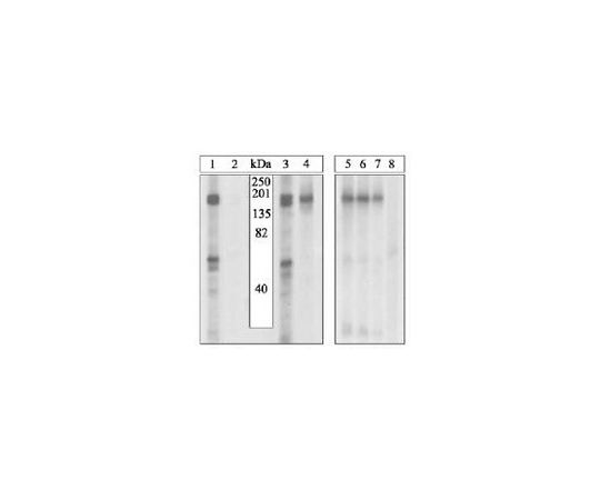 PhosphoDetect(TM) Anti-VEGFR2 (pTyr1054/1059) Rabbit pAb