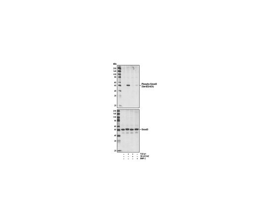 PhosphoDetect(TM) Anti-Smad3 (pSer423/425) Rabbit mAb (C25A9)